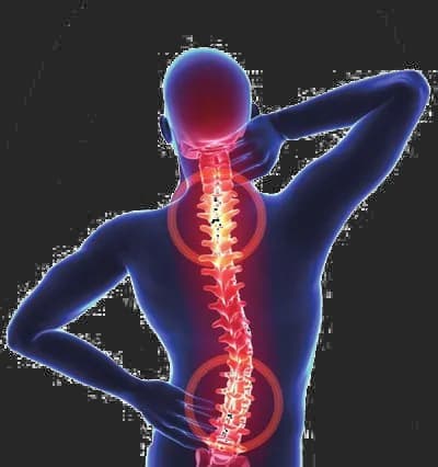 Pain In The Neck, Strain, Tension, Muscle, Therapy PNG