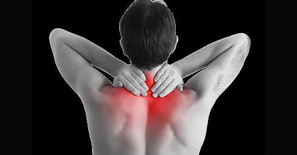 Pain In The Neck, Strain, Discomfort, Therapy, Relief PNG
